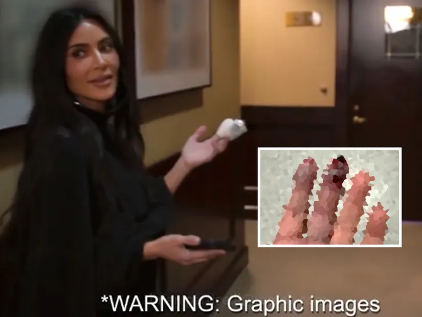 Kim Kardashian Shares Graphic Photos After Breaking Two Fingers – Here’s What Happened: