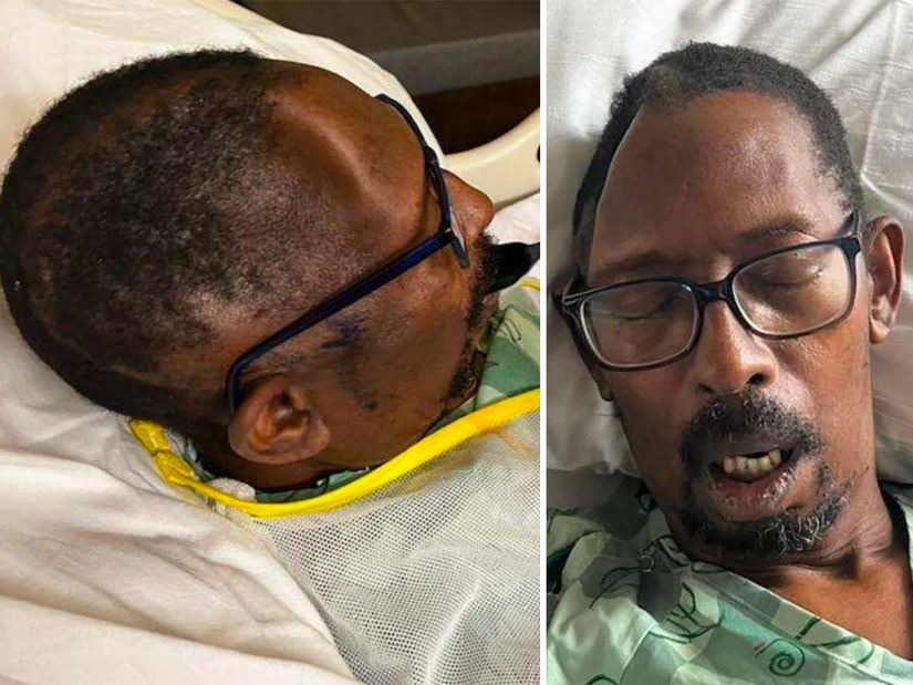 Say What Now? Man Sues Hospital for Allegedly Losing Part of His Skull, Charging Him $19K to Replace It